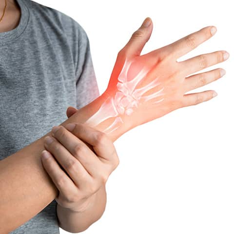 Carpal Tunnel - Midwest Orthopedic Consultants